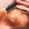 Peekingoose - Dandruff Comb, Stainless Steel Fine Tooth Dandruff Remover, Professional Hair Comb for Kids and Adults (Black)